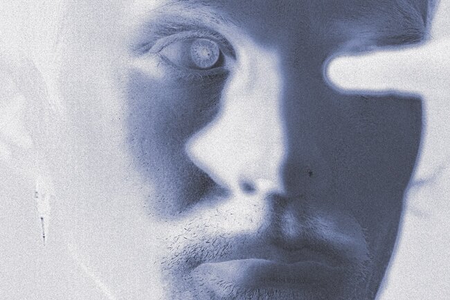 A close-up of a face. It is a negative. The person is looking to the right and has short curly hair. 